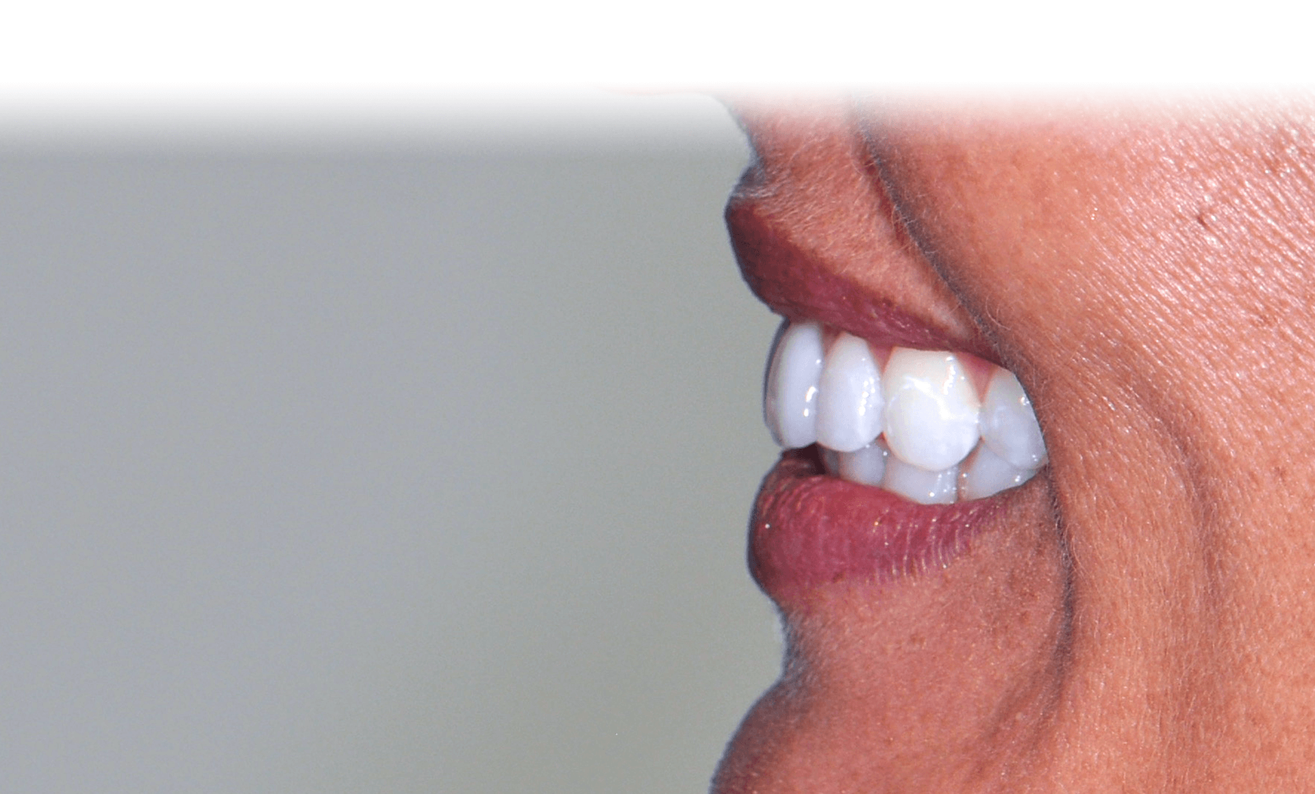 Obeid Cosmetic Dental Chevy Chase