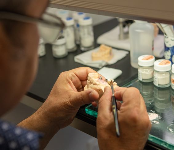 In house lab Top Rated Dentist Obeid Dental Chevy Chase MD