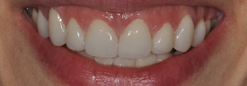 Dr. Youssef Obeid Chevy Chase MD Cosmetic Dentist