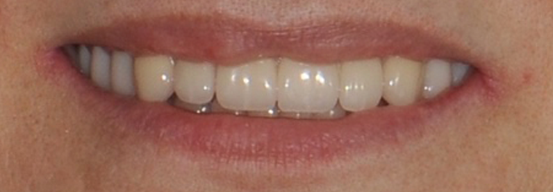 Dr. Youssef Obeid Chevy Chase MD Denture Dentist
