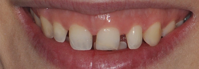 Obeid Chevy Chase MD Cosmetic Dentist