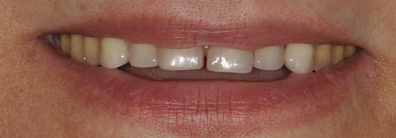 Dr. Youssef Obeid Chevy Chase MD Denture Dentist