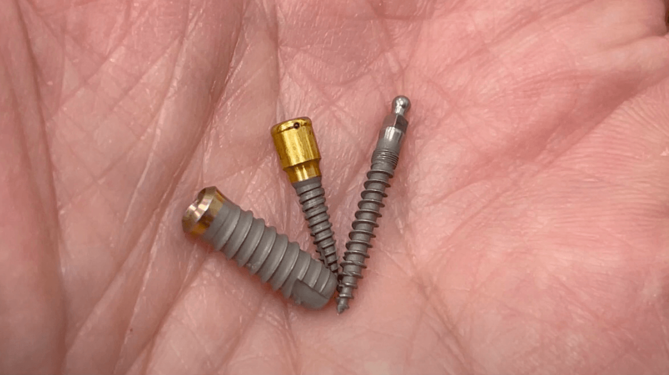 mini-implants